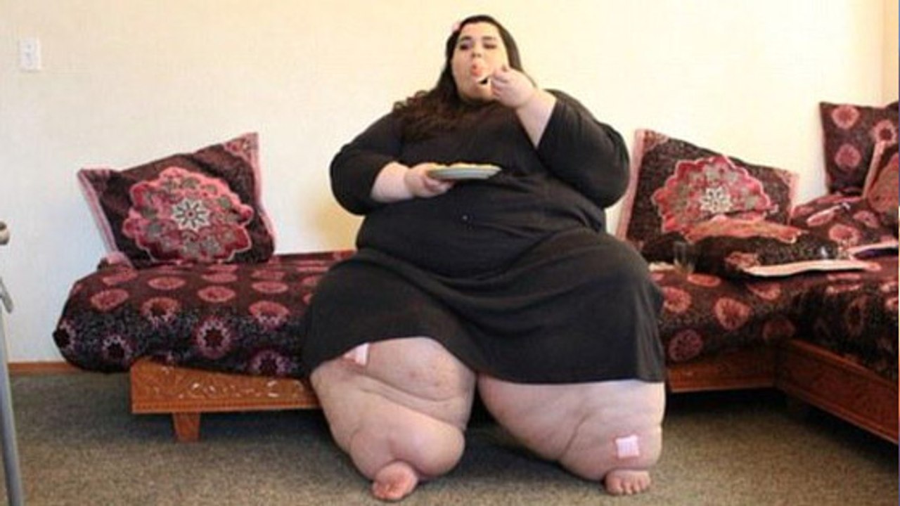 Nach einer OP nimmt diese junge Frau 180 Kilo ab. Sie ist nicht mehr wieder zu erkennen!