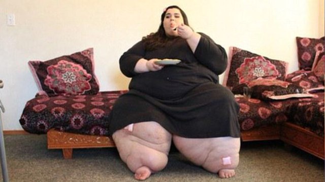 Nach einer OP nimmt diese junge Frau 180 Kilo ab. Sie ist nicht mehr wieder zu erkennen!