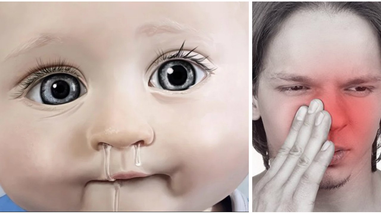 Mit diesem Trick bekommst Du Deine verstopfte Nase im Nu wieder frei!