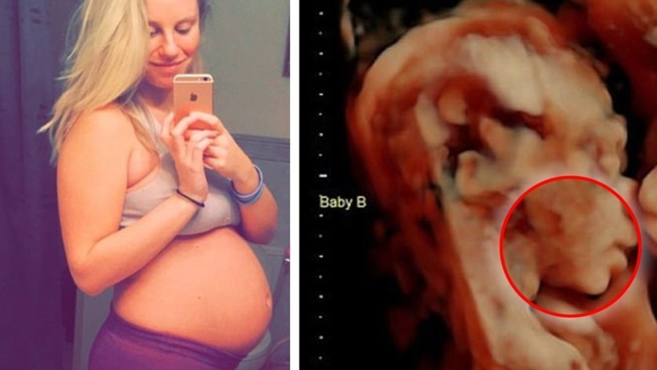 Sie erwartet Zwillinge... Was sie auf der Ultraschallaufnahme beobachtet,ist mehr als einzigartig!