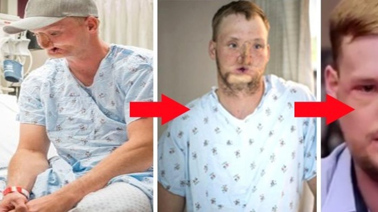 Sein Gesicht ist komplett zerstört, doch einige Jahre später passiert, worauf er nicht mehr zu hoffen wagte!