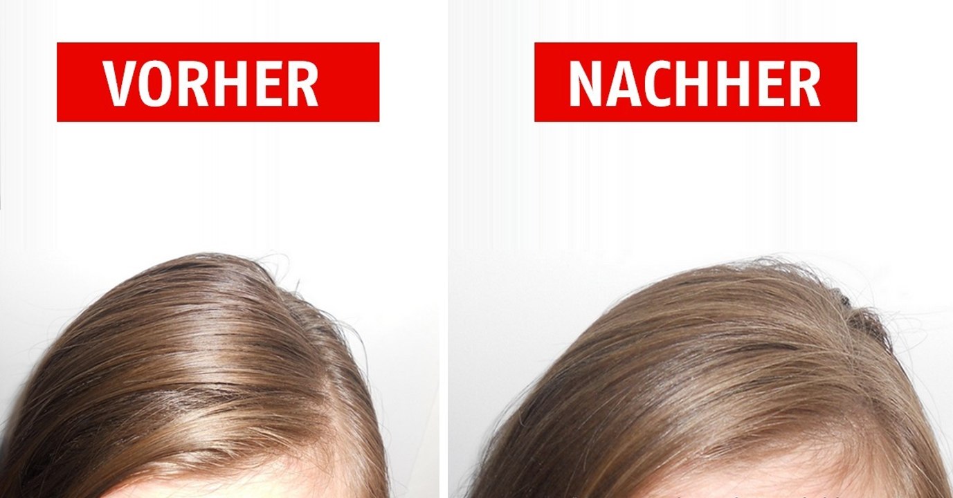 Fettige Haare loswerden: Mit diesen Tricks klappt es!