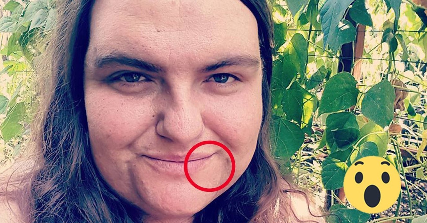 Sie hat einen starken Bartwuchs. Jetzt trifft sie eine radikale Entscheidung!