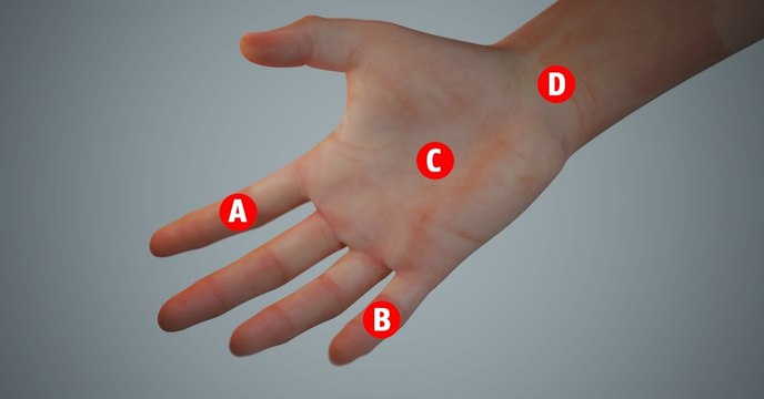 Kribbeln oder wund an diesen Stellen an der Hand? Das sagt es über deine Gesundheit aus!