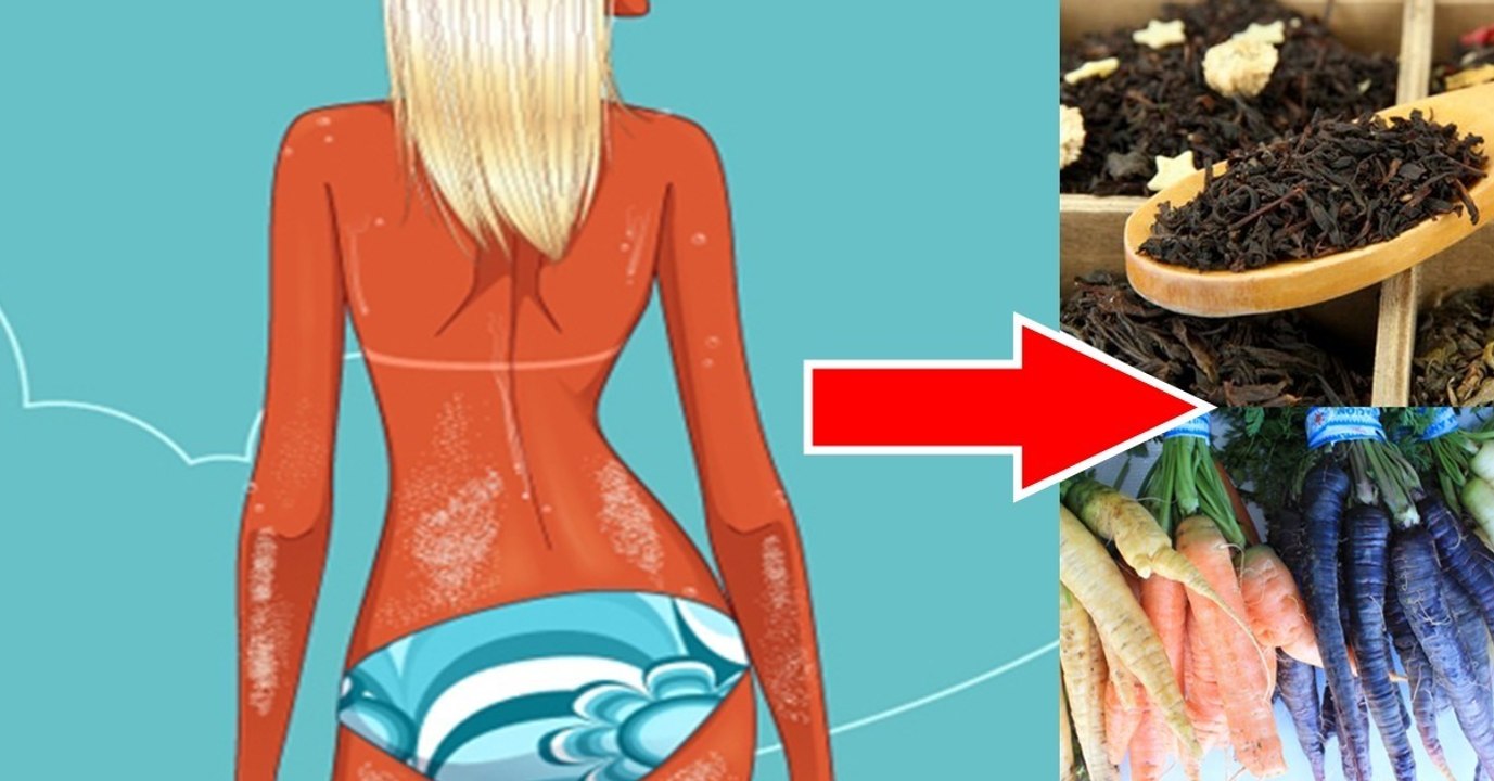 Selbstbräuner selbst gemacht: So geht es!