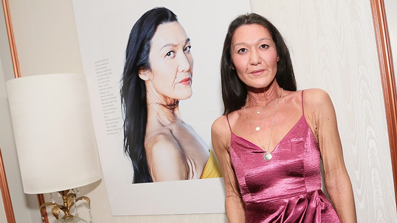 Model leidet an seltener Krankheit, die es alt wirken lässt. Trotzdem macht sie Karriere