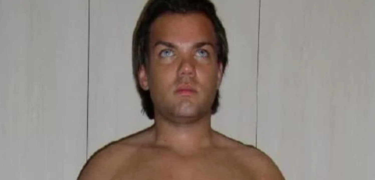 Nach 47 Schönheitsoperationen: Diesen Mann gibt es so nicht mehr