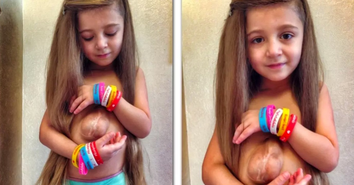 Cantrell-Pentalogie: Wenn das Herz außerhalb des Körpers schlägt