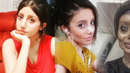 Angelina Jolie: Ein Fan will so aussehen wie sie und unterzieht sich dafür 50 Schönheitsoperationen