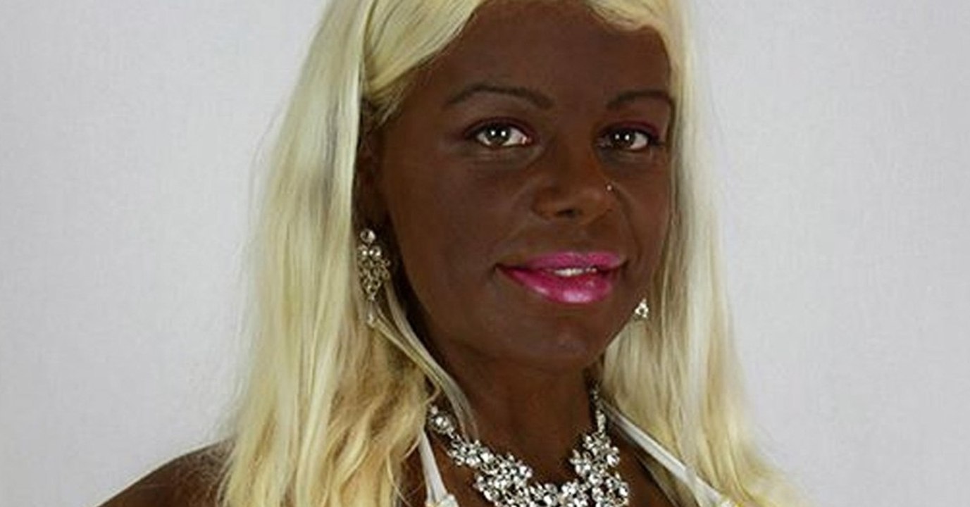 Extremer Schönheitswahn: 'Groß ist nicht groß genug!'