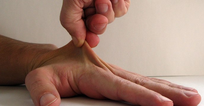 Kein Geld für einen Arzt-Besuch? Dieser Trick ist die Lösung!