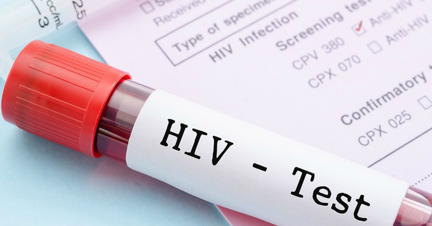 Aids und HIV: Prominente und Stars, die mit dem Virus leben oder an AIDS gestorben sind