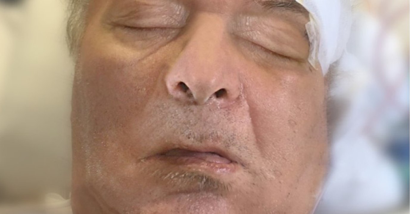 Großes Rätsel um Jogger, der seit März im Koma liegt, bewegt Berliner