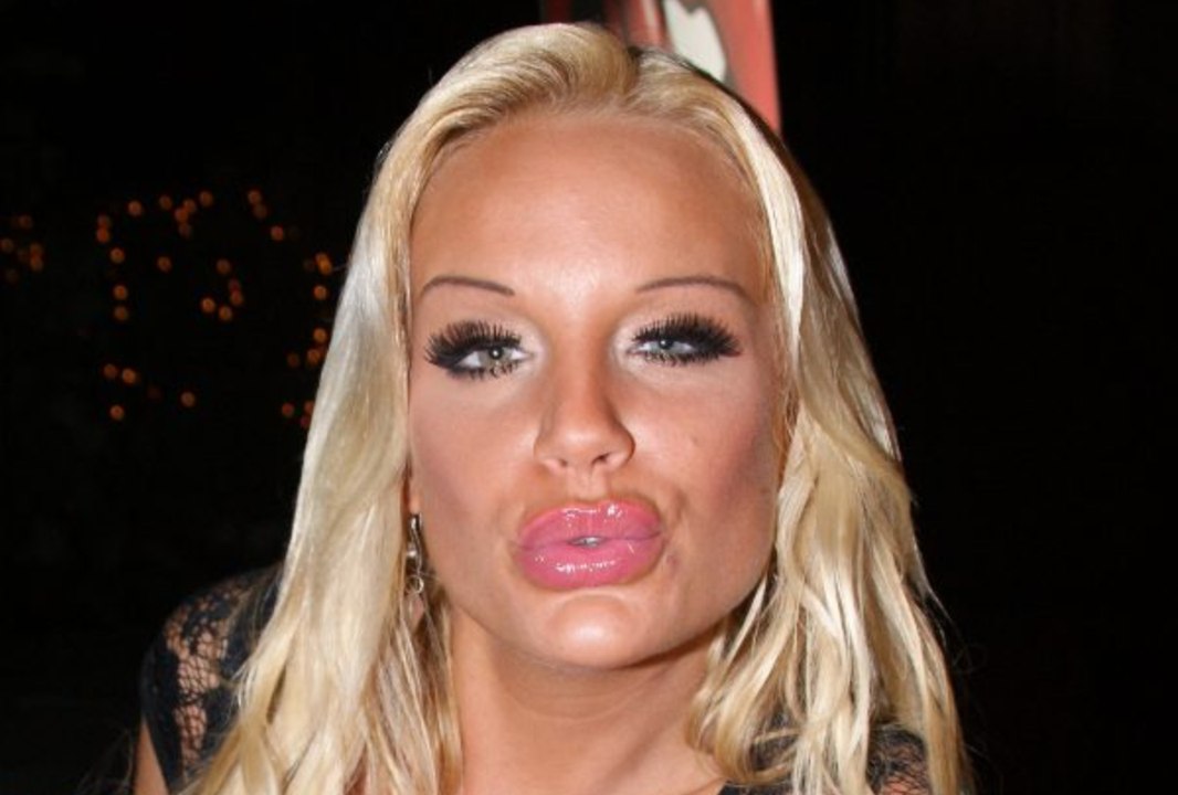 Nicht die Ärzte: Gina Lisa weiß ganz genau, wer schuld an ihrem Gesicht ist