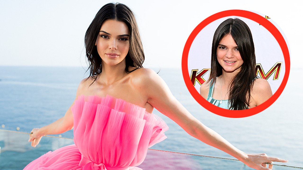 Akne-Probleme: Kendall Jenner spricht über ihren harten Kampf gegen die Pickel