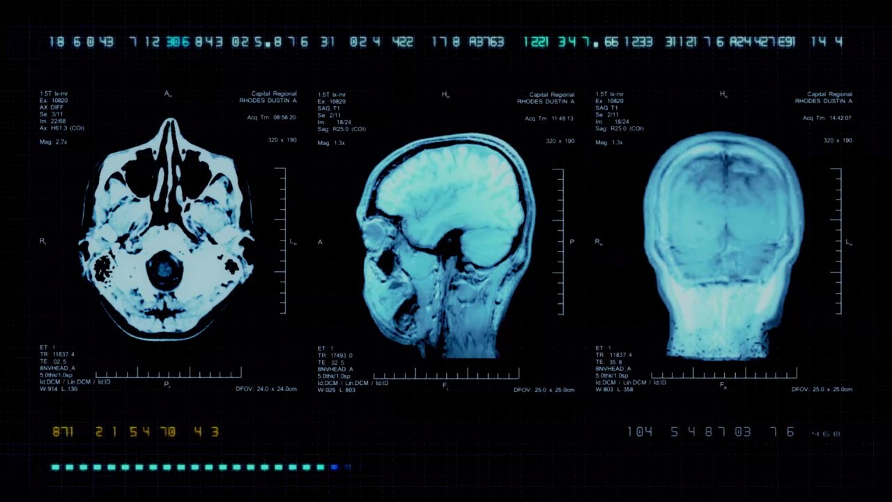 Ärzte behaupten, die junge Frau hätte bloß Migräne: Dann kommt die Hilfe beinahe zu spät