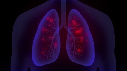 Covid-19: Diese Symptome können noch lange nach einer Infektion auftreten