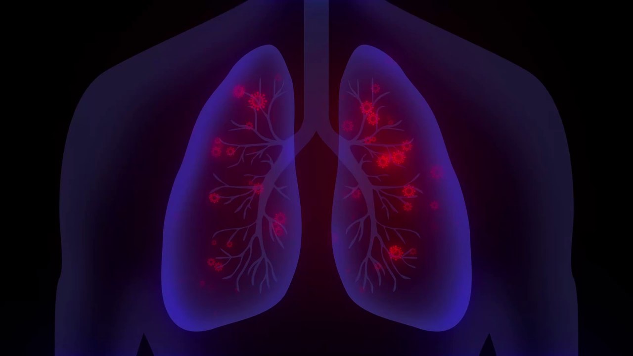 Covid-19: Diese Symptome können noch lange nach einer Infektion auftreten