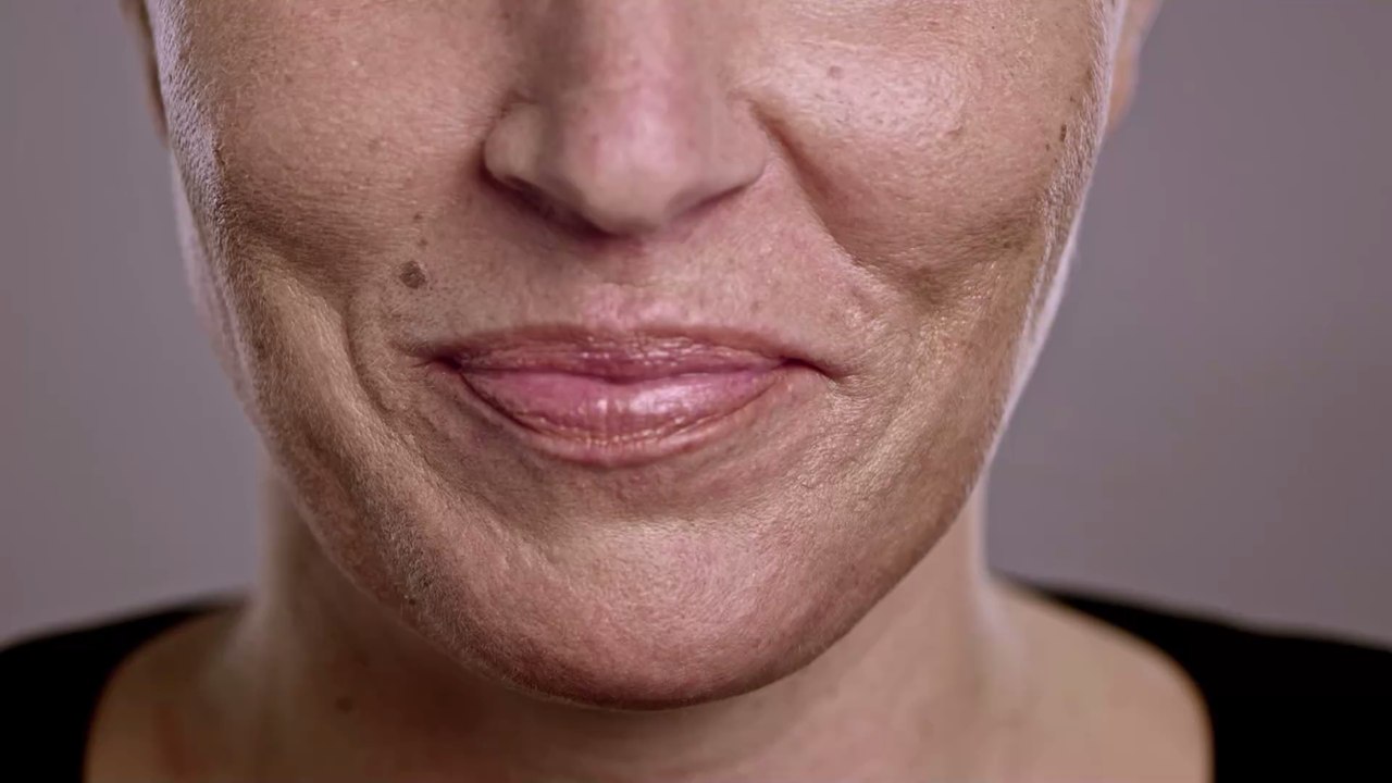 Muttermale: Wie sie entstehen und warum sie so heißen