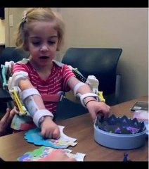 Un exosquelette imprimé en 3D redonne l'usage de ses bras à une fillette