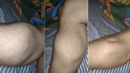 Abgefahren! Ein zu intensives Training führt zu einem nie gesehenen Krampf