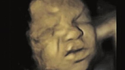 Le foetus apprend à grimacer dans le ventre de sa mère
