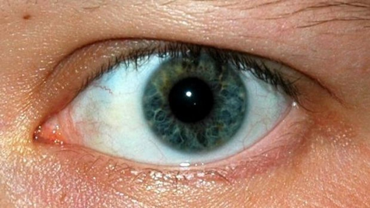 Warum zucken unsere Augenlider manchmal?