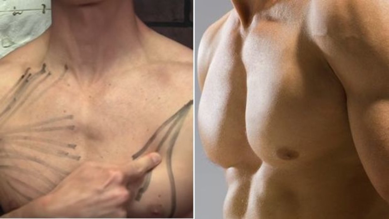 So dehnen Sie Ihre Brustmuskeln effektiv!