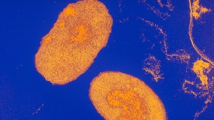 Coqueluche : un vaccin nasal montre des résultats prometteurs