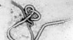 Virus Ebola : définition, symptômes, traitement, de quoi s'agit-il ?