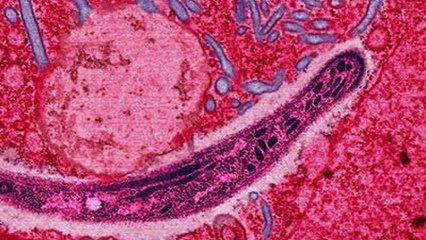 Paludisme : vers un vaccin innovant capable de stopper les parasites ?