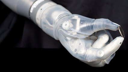 Un bras bionique innovant bientôt commercialisé aux Etats-Unis