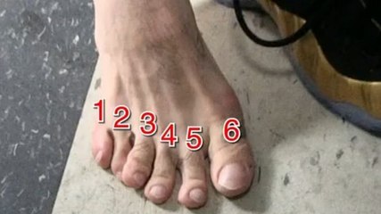 Danny Garcia ist mit seinen 6 Zehen unbesiegbar