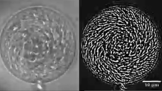 La curieuse nage collective de bactéries dans une goutte d'eau