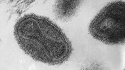 Variole : des échantillons du virus découverts dans des fioles aux Etats-Unis