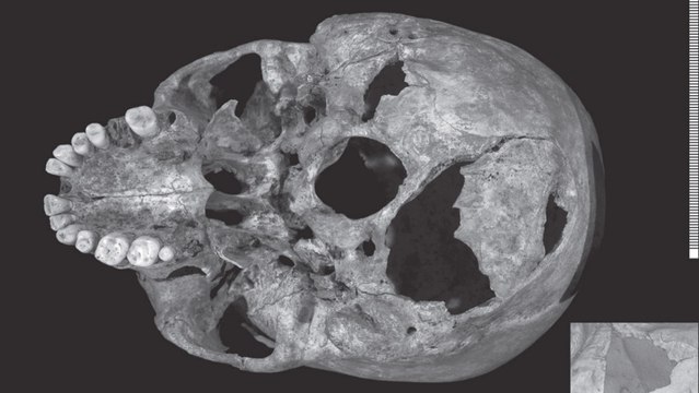 Le squelette de Richard III dévoile les terribles blessures qui ont causé sa mort