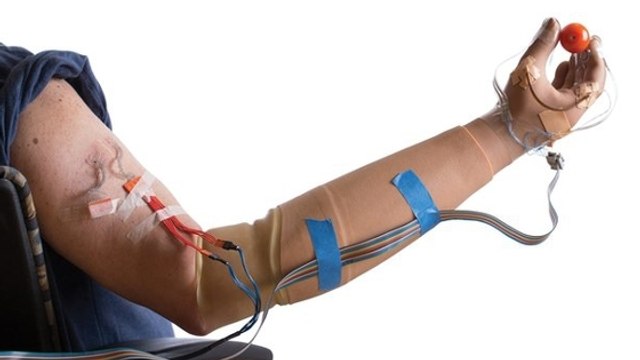 Un bras bionique révolutionnaire rend la sensation du toucher à un homme amputé