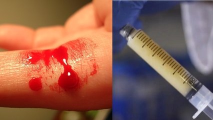 VetiGel, ce gel révolutionnaire capable d'arrêter instantanément les saignements