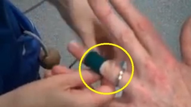 Une astuce infaillible pour retirer une bague coincée à l'aide d'un élastique