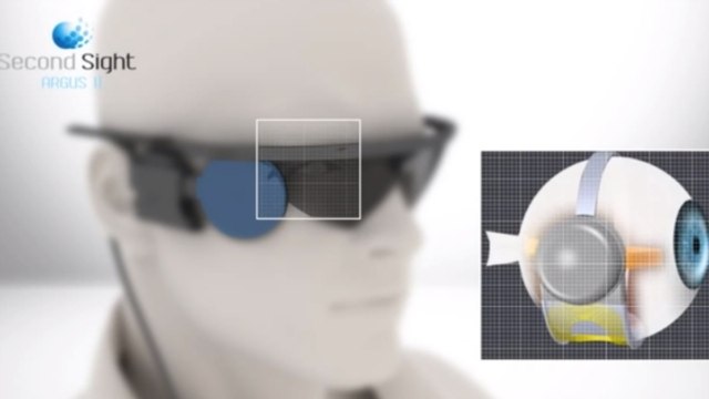 Un ''œil bionique'' rend la vue à une patiente suisse aveugle depuis 15 ans