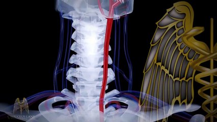 AVC : symptômes, traitement, risques, prévention, comment réagir ?