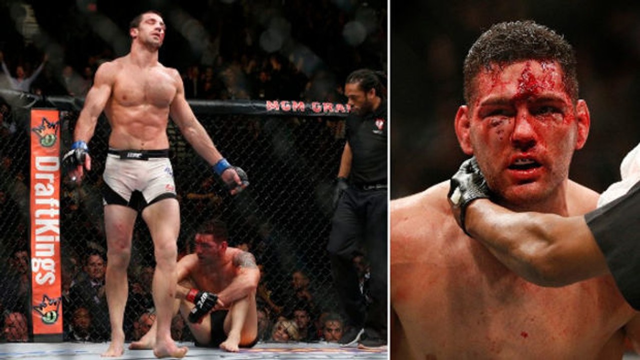 UFC 194: Chris Weidman hat im Kampf um den Titel im Mittellgewicht gegen Luke Rockold ordentlich kassiert