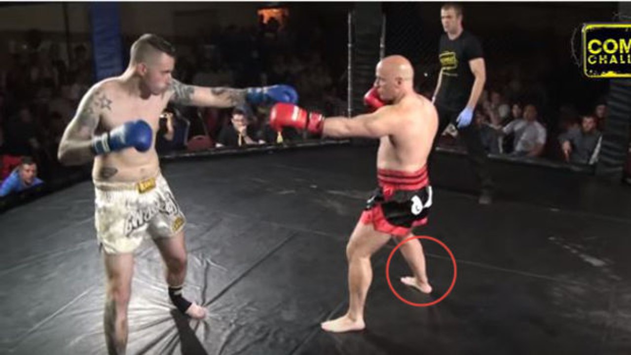 MMA: Ian Ashburne bricht sich nach nur 9 Sekunden Kampf den Knöchel