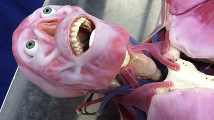 Des cadavres synthétiques au réalisme effrayant pour aider les étudiants en médecine