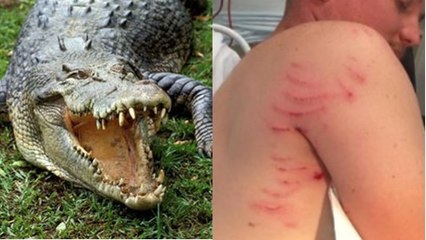 Attaqué par un crocodile, cet Australien a survécu grâce à un réflexe étonnant