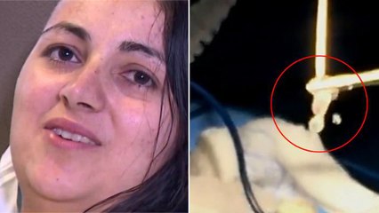 Des médecins font une effrayante découverte dans le crâne d'une Américaine souffrant de maux de tête