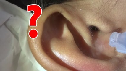 Un homme fait une découverte effrayante dans l'oreille d'un autre