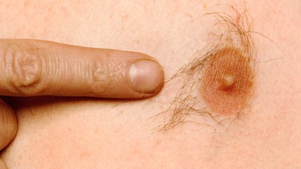 Pourquoi les hommes ont-ils encore des tétons ?