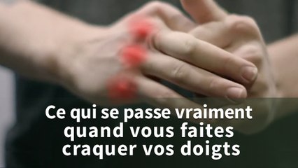 Faire craquer ses doigts : est-ce dangereux pour la santé ?