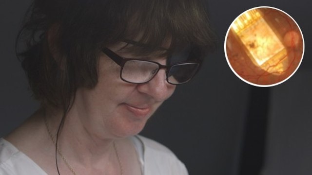 Aveugle depuis six ans, une femme retrouve la vue grâce à un oeil bionique